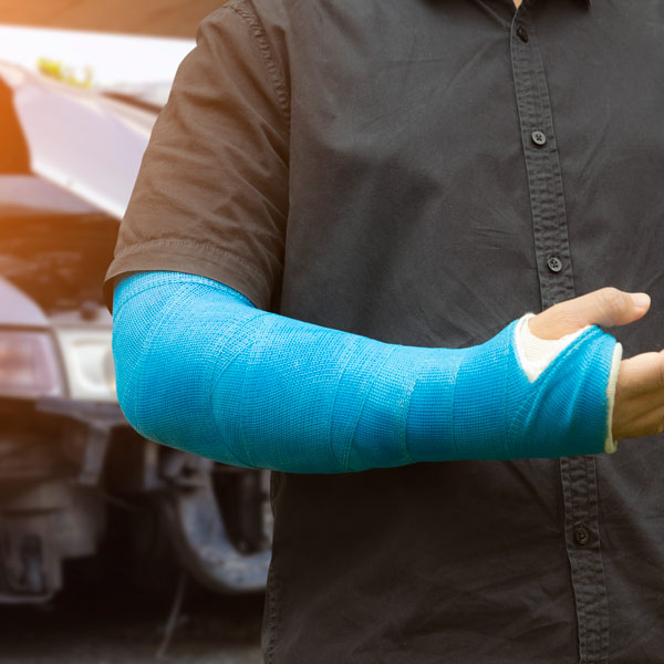 man in cast